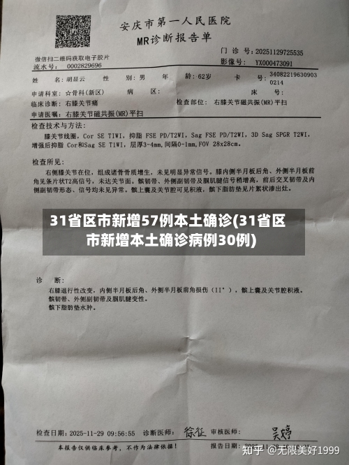 31省区市新增57例本土确诊(31省区市新增本土确诊病例30例)