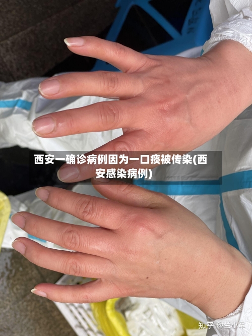 西安一确诊病例因为一口痰被传染(西安感染病例)-第2张图片