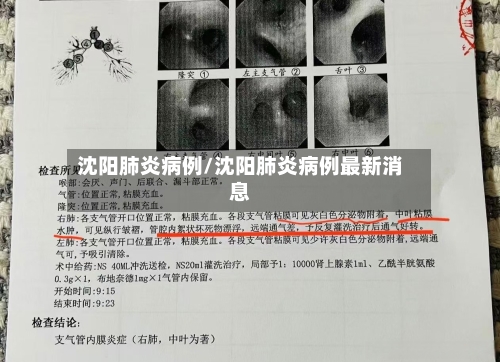 沈阳肺炎病例/沈阳肺炎病例最新消息-第3张图片