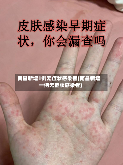 南昌新增1例无症状感染者(南昌新增一例无症状感染者)