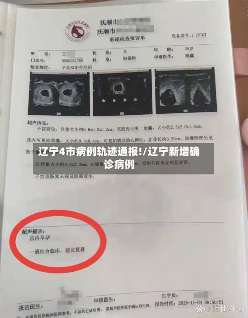 辽宁4市病例轨迹通报!/辽宁新增确诊病例-第2张图片
