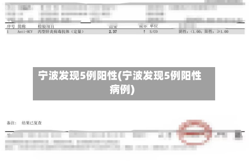 宁波发现5例阳性(宁波发现5例阳性病例)-第2张图片