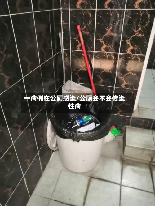 一病例在公厕感染/公厕会不会传染性病-第2张图片